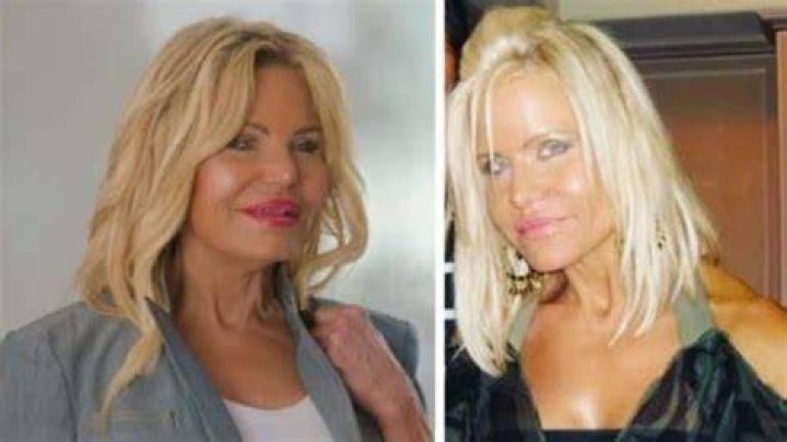 11+ Lisa Helou Plastic Surgery KayrinThailer