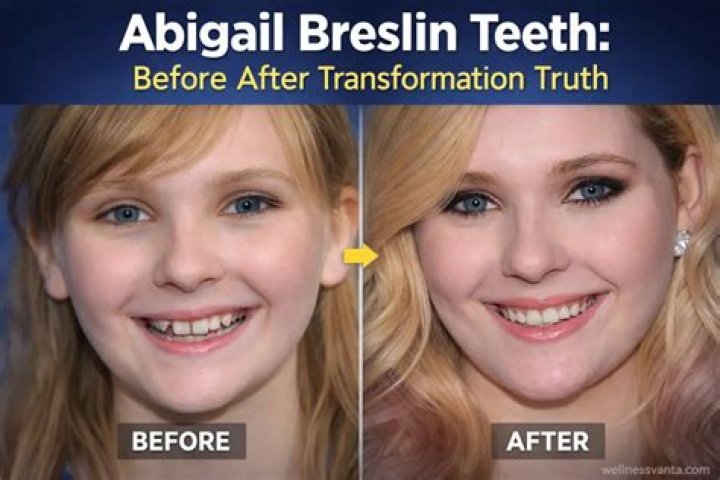 Abigail Breslin Teeth Did She Have Dental Surgery? Before & After