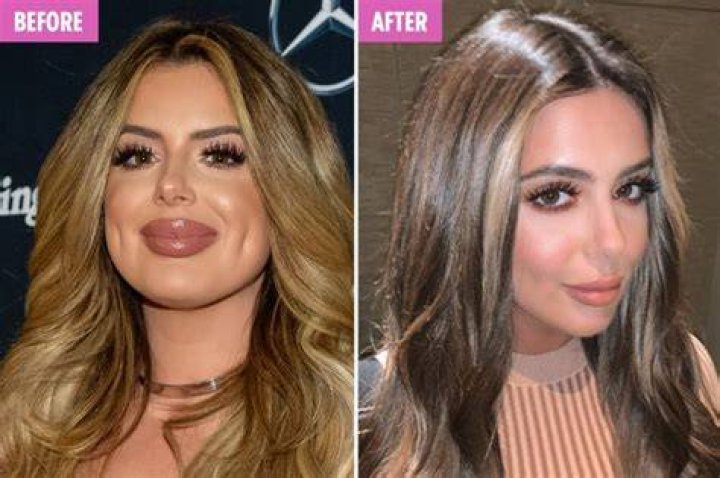 Brielle Biermann Issues Lip Filler Warning with Photos The Daily Dish