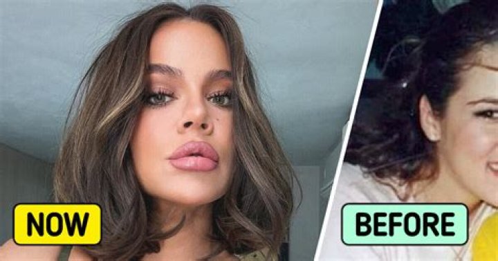 Celebrities Speak Out About Plastic Surgery Before, After Pics