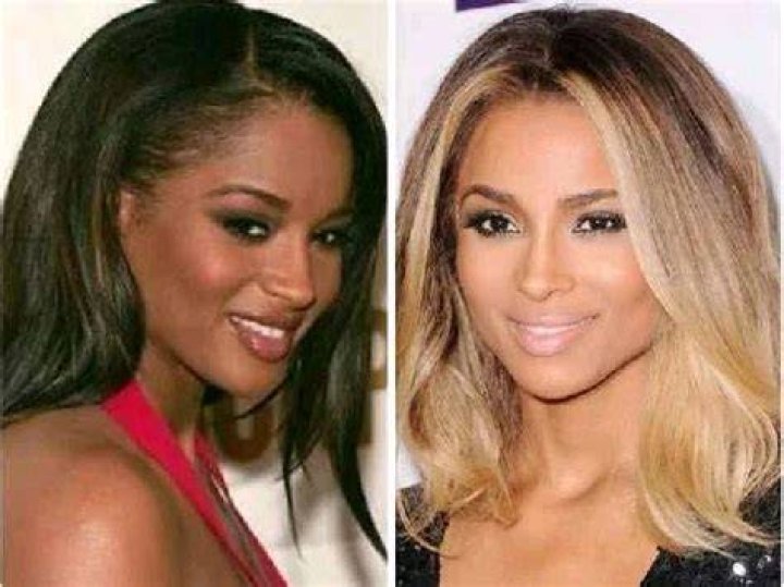 Celebrities Who Have Bleached Their Skin