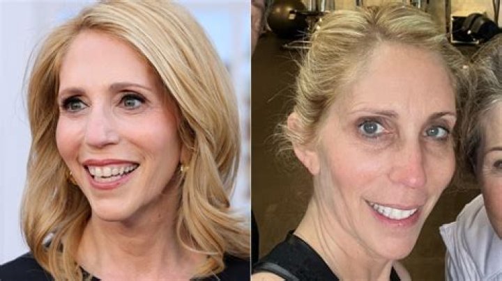 Dana Bash No Makeup 2023 Botox Before And After Photos