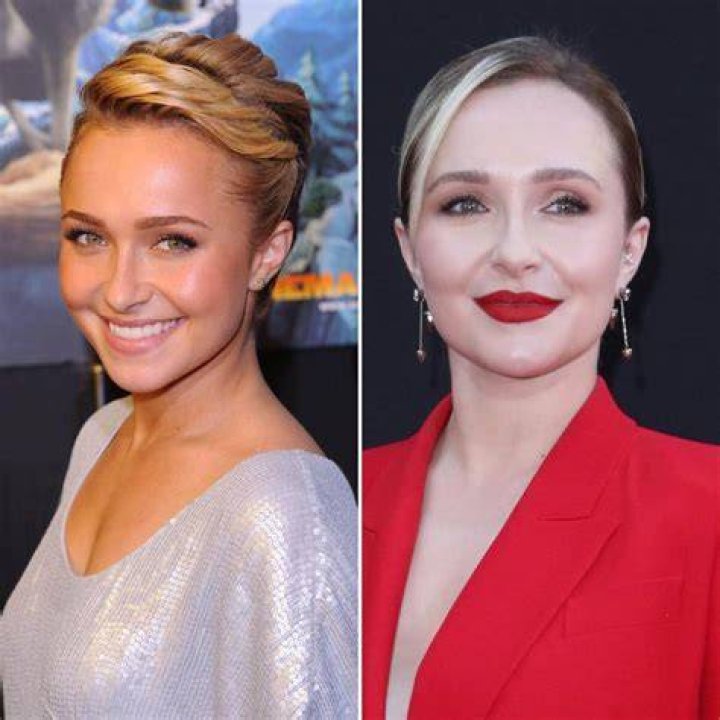 Did Hayden Panettiere Get Plastic Surgery: Before & After!