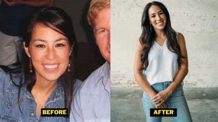 Did Joanna Gaines Have Plastic Surgery? Everything You Need To Know!