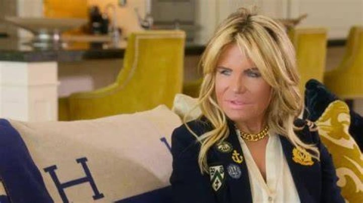 Did Lisa Helou underwent cosmetic surgery Unveiling The Transformation
