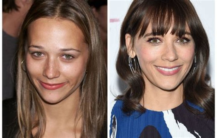 Did Rashida Jones Get Plastic Surgery? Our Experts Weigh In!