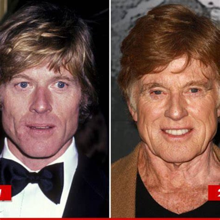 Did Robert Redford Get Plastic Surgery? See His Transformation Through