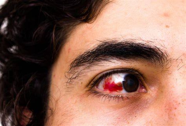 Does Ian Mcshane Have A Glass Eye? Actor Eye Related Injury And Condition Described |