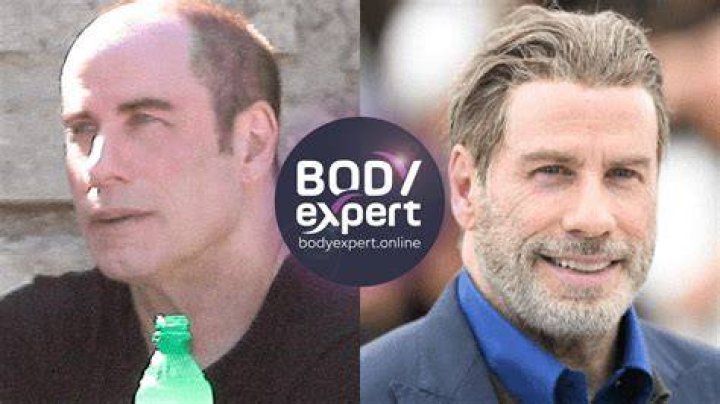 Does Will Arnett Wear A Wig? Murderville Actor Rumored To Have Had An Hair Transplant Or Hair Plug-