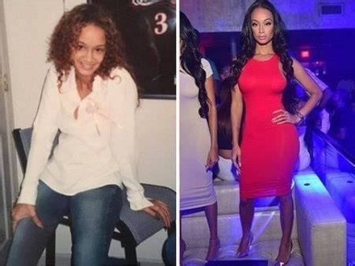 Erica Mena Before And After Plastic Surgery