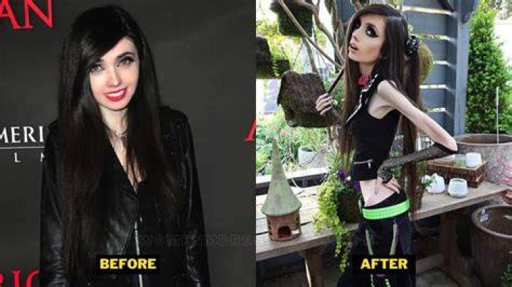 Eugenia Cooney Before After Health Update Now, Weight And Height
