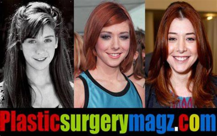 Fans’ Focus on Alyson Hannigan’s Plastic Surgery and Breast Implants!Do the rumors about Alyson Hannigan’s plastic surgery exist?