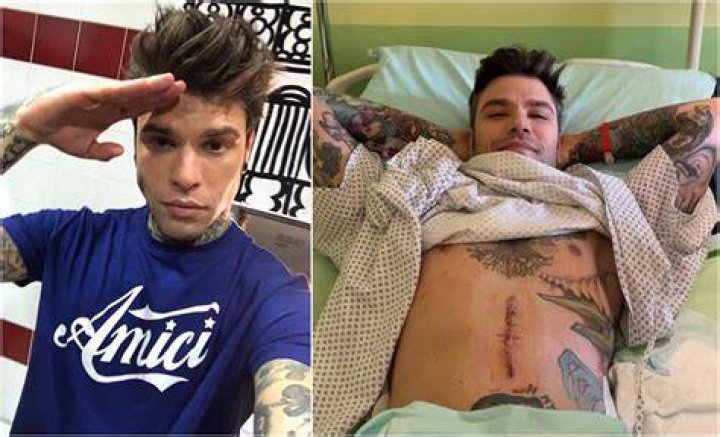 Fedez operated on successfully for rare pancreatic cancer TVMnews.mt