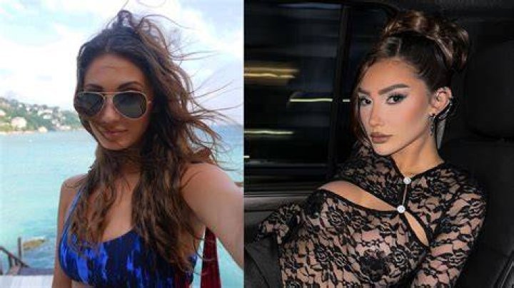 Francesca Farago Before Surgery: What Did She Change?