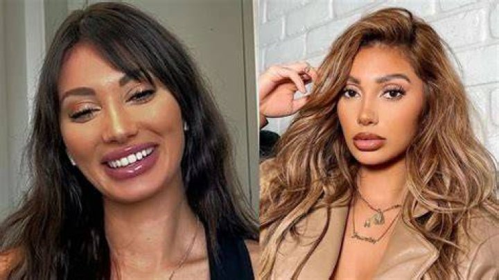 Francesca Farago Before Surgery