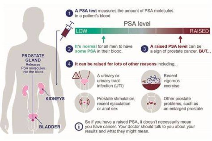 Guidance updated on PSA testing for prostate cancer PHE Screening