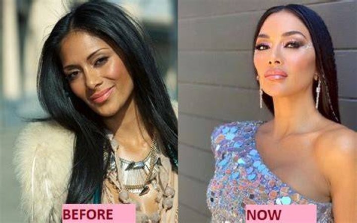 Is Nicole Scherzinger Pregnant Again in 2022? Before & After Surgery Pictures Of The Masked Singer J