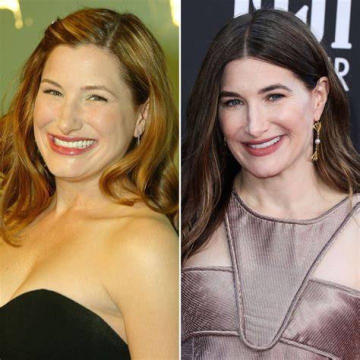 Kathryn Hahn Plastic Surgery Before and After