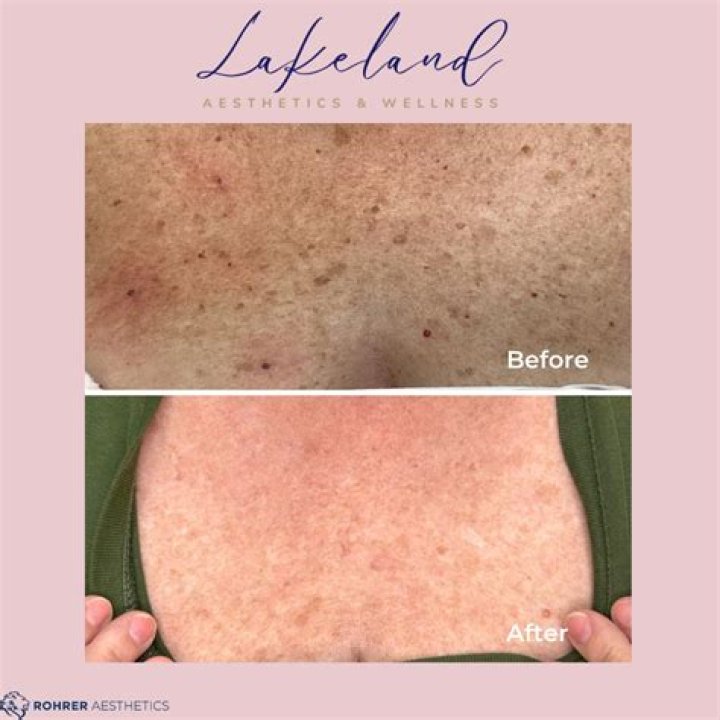 Lakeland Aesthetics & Wellness