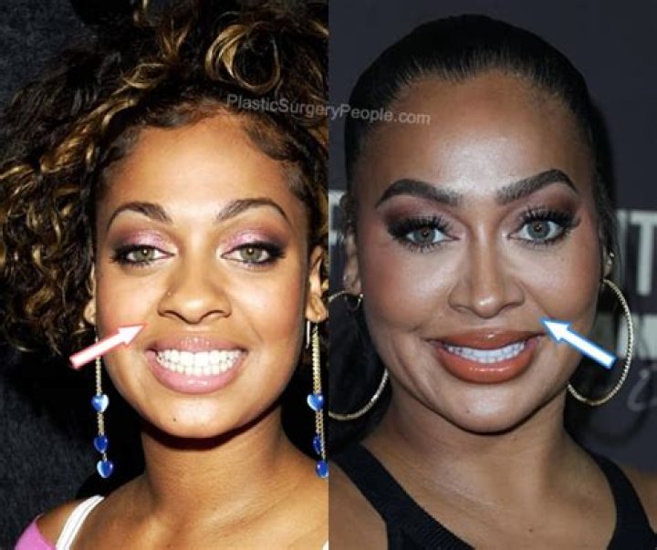 Lala Anthony Before and After Plastic Surgery, Who is Lala Anthony