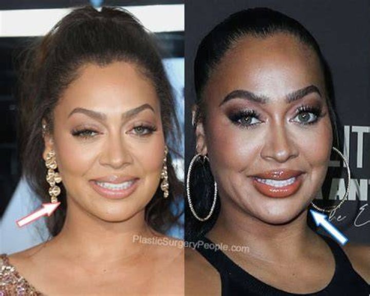 Lala Anthony Plastic Surgery Boobs (Boob Job), Nose Job and Botox