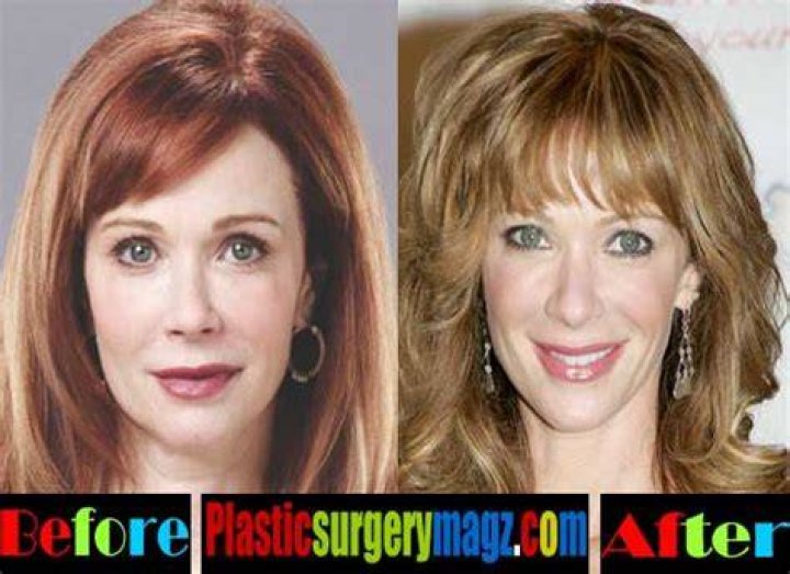 Lauren Holly Plastic Surgery Botox, Breast Increase, Nose Job