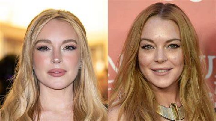 Lindsay Lohan Plastic Surgery Is She Done With It?