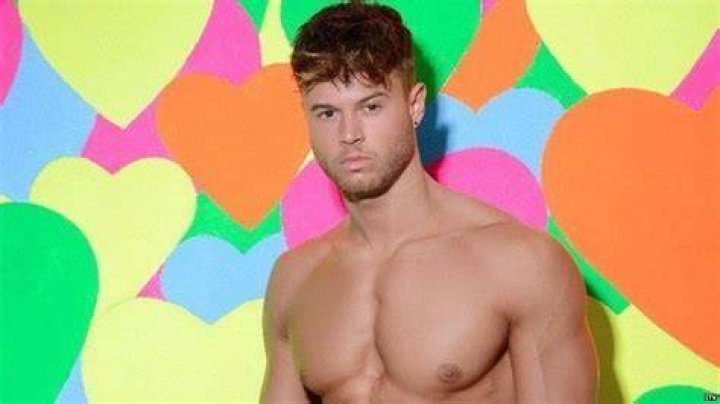 Love Island star Alex Beattie shares shock hair transplant photo
