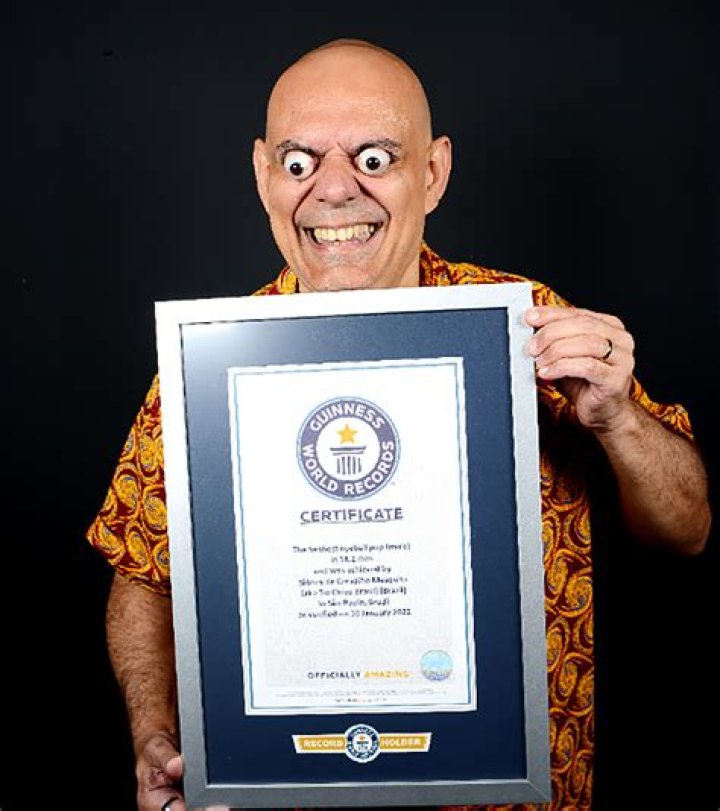 Man breaks world record for farthest eyeball pop