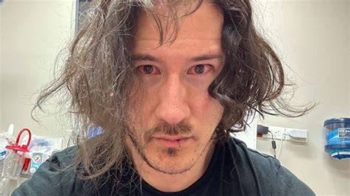 Markiplier explains why he went to the hospital after disturbing selfie