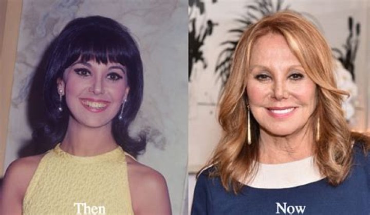 marlo thomas plastic surgery