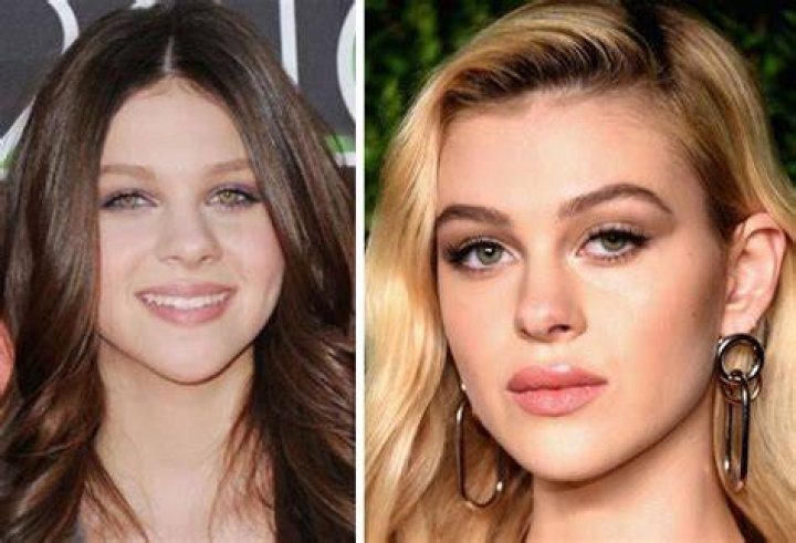 Nicola Peltz Before And After Plastic Surgery Photos |