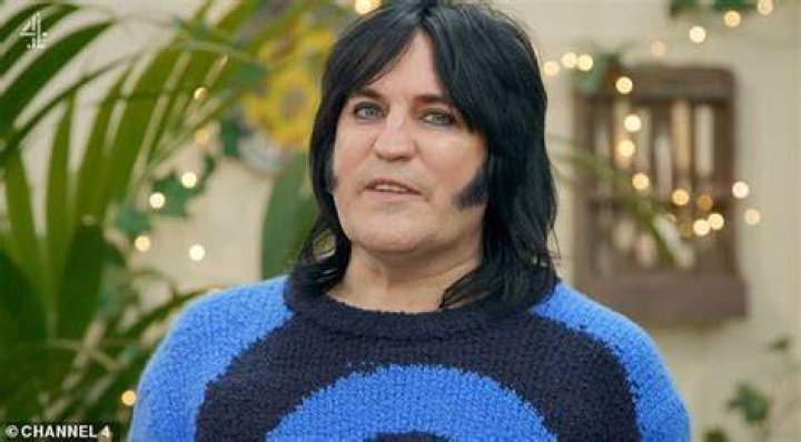 Noel Fielding Health Update What Happened To Him?