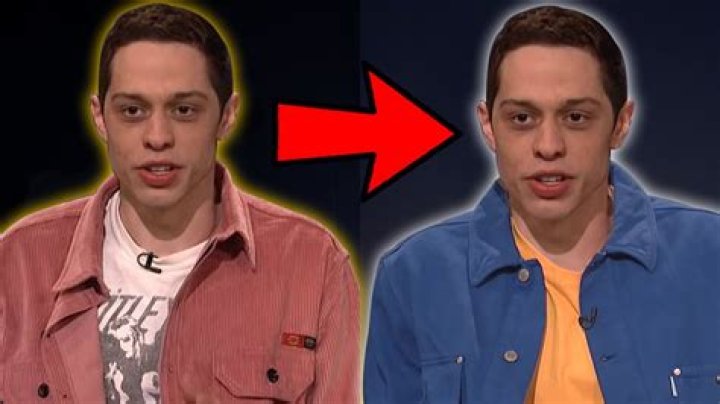 Pete Davidson Takes Finasteride To Prevent Hair Loss Before And After
