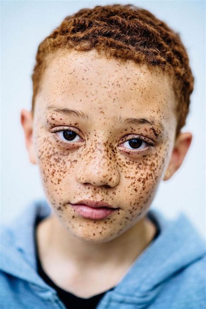 Photographer Explores The Beautiful Diversity Of Redheads Of Color