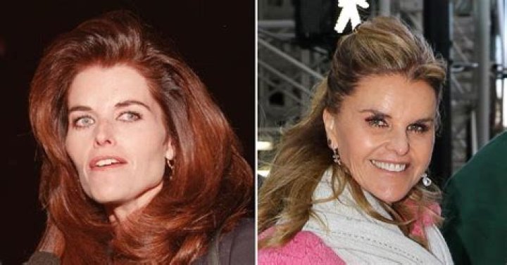 Plastic Surgeons Shocked At Arnold Schwarzenegger&rsquo;s ExWife Maria
