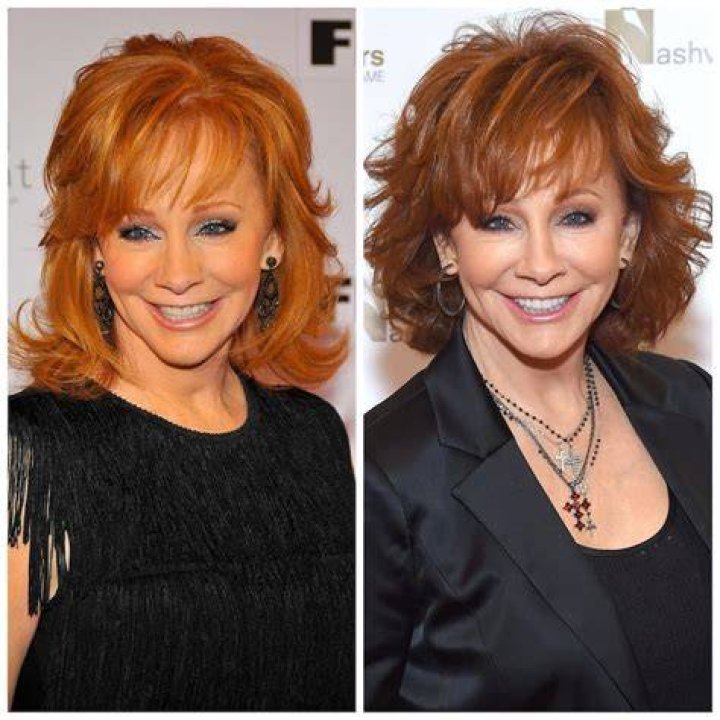 Reba McEntire's Plastic Surgery Rumors Revealed