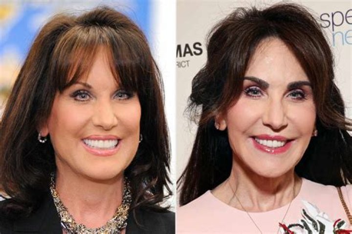 Robin McGraw Reveals She Got an Eyebrow Transplant