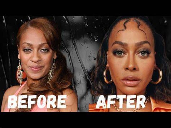 The Transformation of Lala Anthony Before and After Surgery