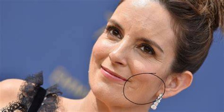 Uncover The Secrets Of Tina Fey's Scar: A Journey Of Discovery