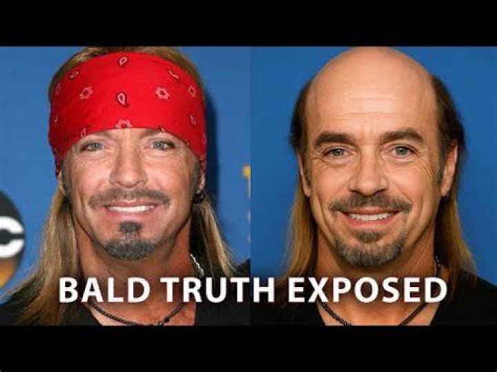 Uncovering The Truth About Brett Michaels Bald Rumors