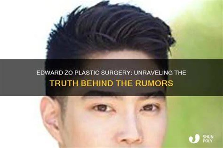 Unraveling The Truth Behind The Surgery Rumors