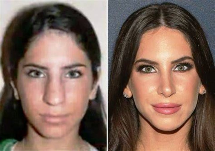 Unveiling The Secrets Of The Enchanting "Jen Selter Nose"