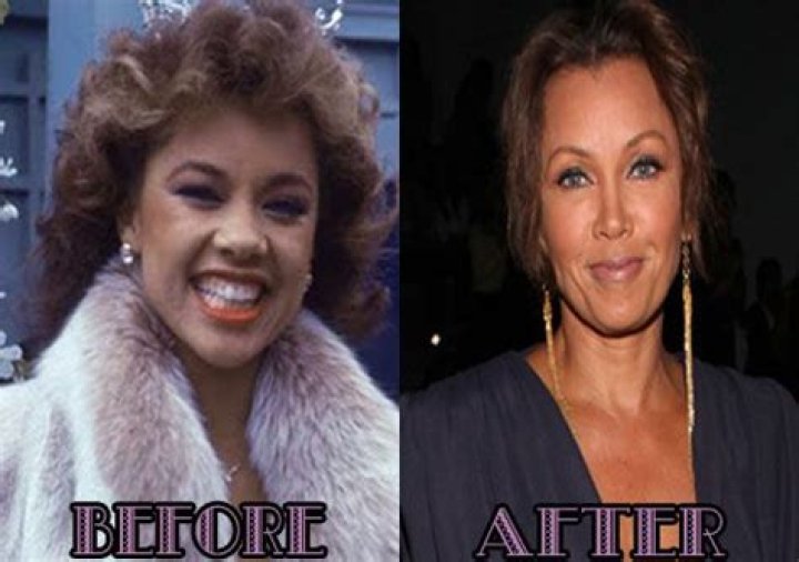 Vanessa Williams nose job