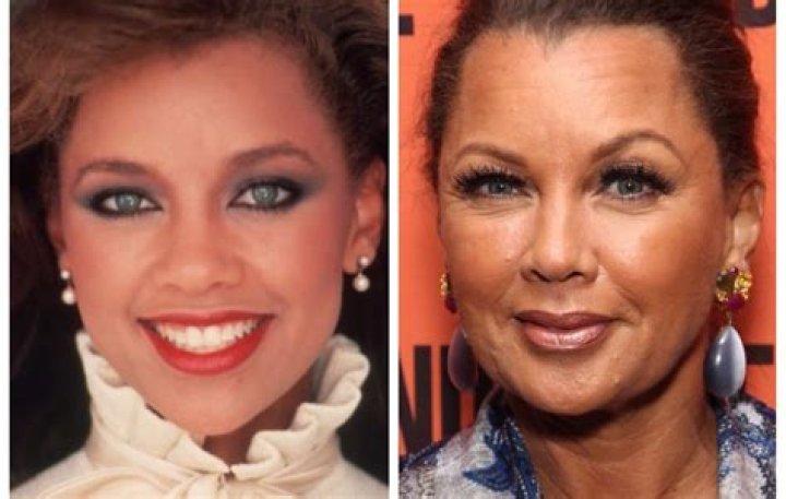Vanessa Williams&rsquo; Plastic Surgery Profile She&rsquo;s Admitted to Botox