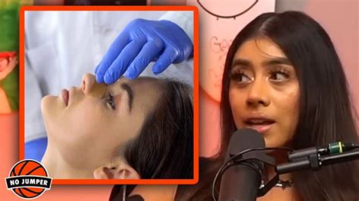 Violet Myers Reveals Why She Got a Nose Job YouTube