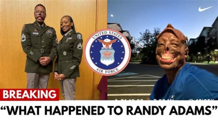 What Happened to Randy Adams Face? Randy Adams Face Burn Before and