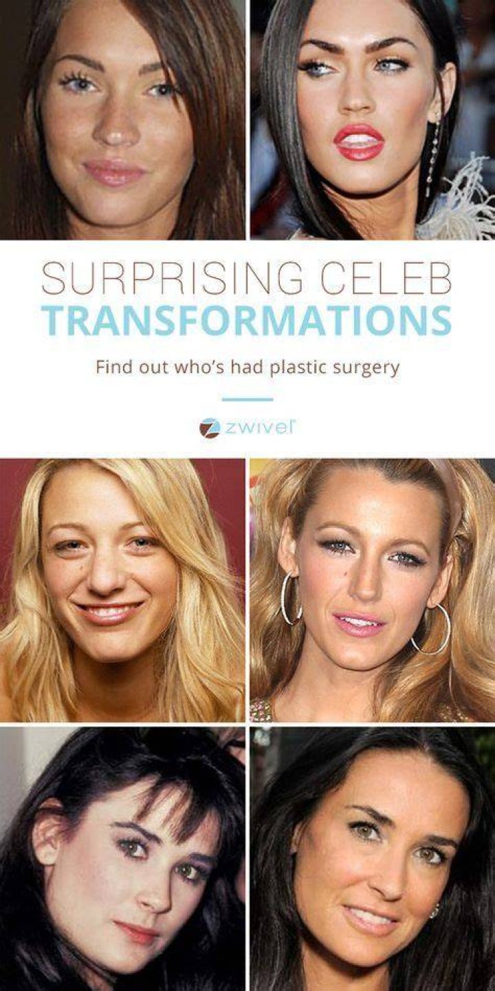 Which celebrities have had cosmetic surgery? Mirror Online
