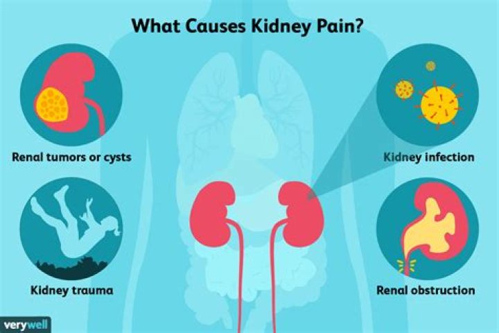 Why Do My Kidneys Hurt So Much