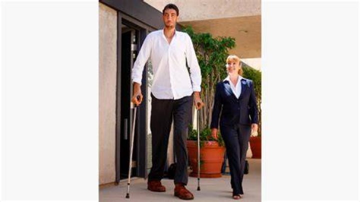 Will He Recover From Gigantism or Elephantitis? Health Update |